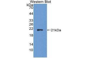 Detection of Recombinant CDKN2A, Rat using Polyclonal Antibody to Cyclin Dependent Kinase Inhibitor 2A (CDKN2A) (CDKN2A Antikörper  (AA 3-155))