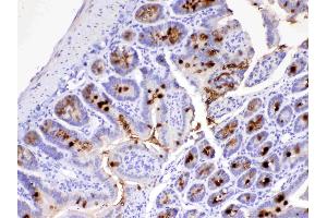 IHC analysis of MUC2 using anti-MUC2 antibody . (MUC2 Antikörper)