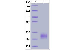 SDS-PAGE (SDS) image for Interleukin 5 (IL5) (AA 20-134) (Active) protein (His tag) (ABIN6938893)