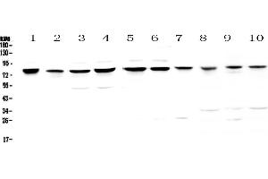 Western blot analysis of PARN using anti-PARN antibody . (PARN Antikörper  (AA 1-301))