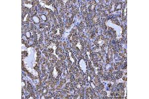 IHC analysis of NDUFS5 using anti-NDUFS5 antibody (ABIN7598943).
