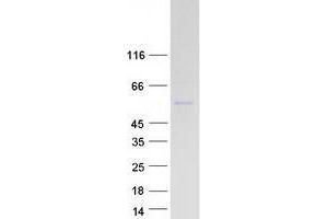 Western Blotting (WB) image for Phosphatidylinositol 4-Kinase Type 2 alpha (PI4K2A) protein (Myc-DYKDDDDK Tag) (ABIN2728876)