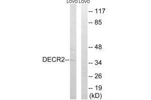 Western blot analysis of extracts from LOVO cells, using DECR2 antibody. (DECR2 Antikörper)