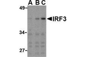 Western blot analysis of IRF3 in Ramos whole cell lysate with AP30447PU-N IRF3 antibody at (A) 1, (B) 2, and (C) 4 μg/ml. (IRF3 Antikörper  (C-Term))