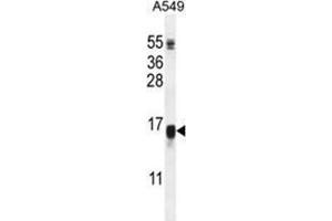 WFDC12 Antibody (C-term) western blot analysis in A549 cell line lysates (35 µg/lane). (WFDC12 Antikörper  (C-Term))