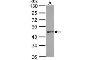 WB Image Sample (30 ug of whole cell lysate) A: A431 , 10% SDS PAGE PON2 antibody antibody diluted at 1:1000 (PON2 Antikörper)