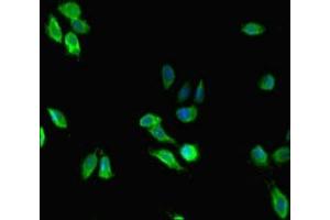 Immunofluorescent analysis of Hela cells using ABIN7159407 at dilution of 1: 100 and Alexa Fluor 488-congugated AffiniPure Goat Anti-Rabbit IgG(H+L) (Menin Antikörper  (AA 1-615))