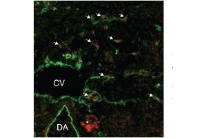 Human lymphatic endothelial; lymphatic endothelial cell tissue and primary (1/50 up to 1/500) secondary 1/200; SOX18 antibody - middle region in Human lymphatic endothelial cells using Immunofluorescence (SOX18 Antikörper  (Middle Region))