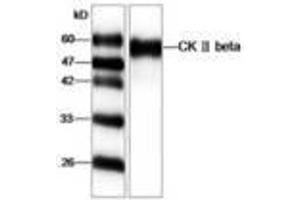 Image no. 1 for anti-Casein Kinase 2, beta (CSNK2B) antibody (ABIN791461) (CSNK2B Antikörper)