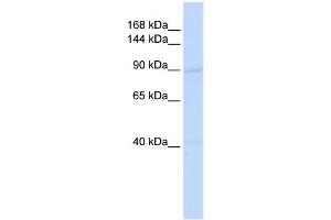 WB Suggested Anti-RAD54B Antibody Titration:  0. (RAD54B Antikörper  (Middle Region))