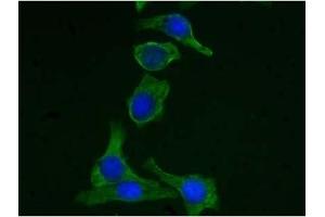 Immunofluorescence (IF) image for anti-Keratin 19 (KRT19) (C-Term) antibody (ABIN371616) (Cytokeratin 19 Antikörper  (C-Term))