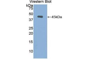 Western Blotting (WB) image for anti-Gelsolin (GSN) (AA 432-553) antibody (ABIN1078060) (Gelsolin Antikörper  (AA 432-553))