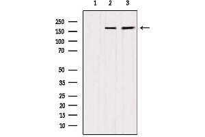 Western blot analysis of extracts from various samples, using MYOM2 Antibody. (MYOM2 Antikörper  (Internal Region))
