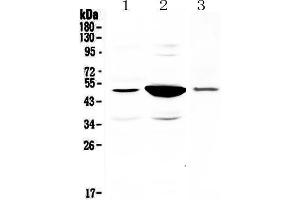 Western blot analysis of PAI1 using anti-PAI1 antibody . (PAI1 Antikörper  (AA 24-240))