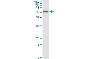 Immunoprecipitation of PSMD5 transfected lysate using anti-PSMD5 MaxPab rabbit polyclonal antibody and Protein A Magnetic Bead , and immunoblotted with PSMD5 purified MaxPab mouse polyclonal antibody (B01P) . (PSMD5 Antikörper  (AA 1-504))