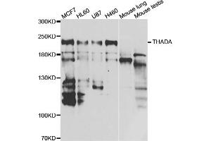 Western blot analysis of extracts of various cell lines, using THADA antibody (ABIN5974287) at 1/1000 dilution. (THADA Antikörper)