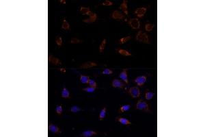 Immunofluorescence analysis of NIH-3T3 cells using MTCH2 Polyclonal Antibody  at dilution of 1:100 (40x lens). (MTCH2 Antikörper  (AA 30-175))