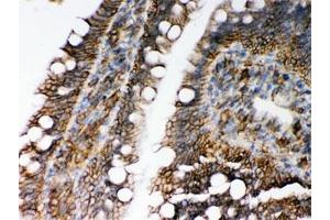 IHC testing of FFPE rat intestine with HLA-C antibody. (HLA-C Antikörper)