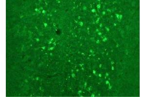 Immunostaining of rat cerebellum showing fluorescence of calretinin containing cells. (Calretinin Antikörper)