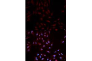 Immunofluorescence analysis of U2OS cells using Phospho-MAPK14-Y322 antibody (ABIN5969909). (MAPK14 Antikörper  (pTyr322))