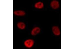 ABIN6275694 staining HepG2 by IF/ICC. (ZNF771 Antikörper  (Internal Region))