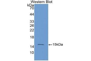 Western blot analysis of the recombinant protein. (HRAS Antikörper  (AA 82-176))