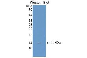 Western blot analysis of the recombinant protein. (CUBN Antikörper  (AA 3511-3623))