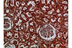 Immunohistochemical analysis of paraffin-embedded Human-kidney, antibody was diluted at 1:100 (EYA1 Antikörper)