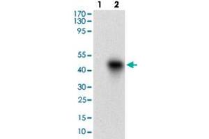 Western blot analysis of Lane 1: Negative control [HEK293 cell lysate]; Lane 2: Over-expression lysate [ROR2 (AA: 59-155)-hIgGFc transfected HEK293 cells] with ROR2 monoclonal antibody, clone 6F2D10  at 1:500-1:2000 dilution. (ROR2 Antikörper  (AA 59-155))