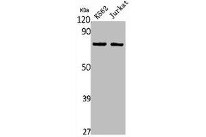 Western Blot analysis of K562 Jurkat cells using HGFA Polyclonal Antibody (HGFA Antikörper  (C-Term))