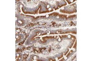 Immunohistochemical staining of human duodenum with PARP12 polyclonal antibody  shows strong cytoplasmic positivity in glandular cells. (PARP12 Antikörper)