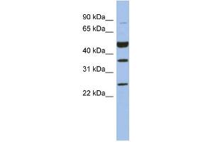WB Suggested Anti-MAGEB3 Antibody Titration: 0.