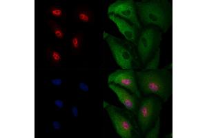 ABIN6265255 and ABIN6277135 staining  cells by IF/ICC. (SPDYA Antikörper  (Internal Region))