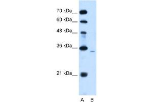 WB Suggested Anti-PPAP2A Antibody Titration:  2. (PPAP2A Antikörper  (Middle Region))