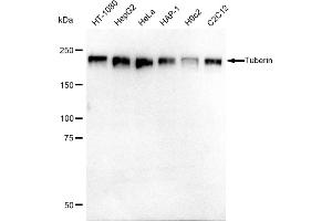 Western blotting analysis using Tuberin antibody (ABIN7800657). (Rekombinanter Tuberin Antikörper)