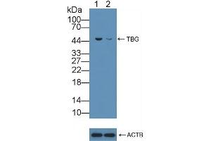 Knockout Varification: Lane 1: Wild-type Hela cell lysate, Lane 2: TBG knockout Hela cell lysate, Predicted MW: 46kd Observed MW: 46kd Primary Ab: 5 μg/mL Rabbit Anti-Human TBG Antibody Second Ab: 0. (SERPINA7 Antikörper  (AA 128-415))
