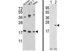 Image no. 1 for anti-Cofilin 1 (CFL1) (N-Term) antibody (ABIN452840) (Cofilin Antikörper  (N-Term))