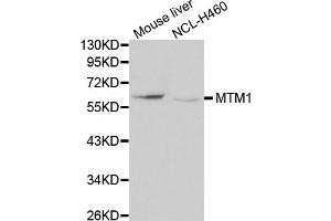 Western blot analysis of extracts of various cell lines, using MTM1 antibody (ABIN5970085) at 1/1000 dilution. (MTM1 Antikörper)