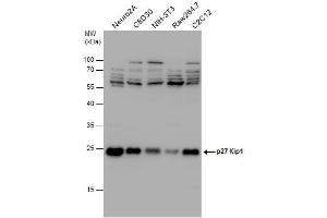 WB Image p27 Kip1 antibody detects p27 Kip1 protein by western blot analysis. (CDKN1B Antikörper)