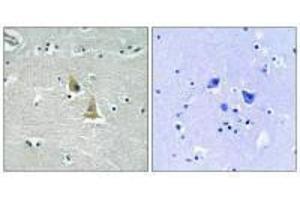 Immunohistochemistry analysis of paraffin-embedded human brain tissue using p47 phox (Ab-345) antibody. (NCF1 Antikörper  (Ser345))