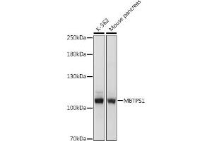 Western blot analysis of extracts of various cell lines, using MBTPS1 antibody (ABIN7268470) at 1:1000 dilution. (MBTPS1 Antikörper  (AA 803-1052))