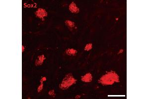 Sox2 antibody (pAb) tested by Immunofluorescence. (SOX2 Antikörper  (C-Term))