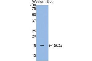 Detection of Recombinant TGFb2, Rat using Polyclonal Antibody to Transforming Growth Factor Beta 2 (TGFb2) (TGFB2 Antikörper  (AA 331-442))