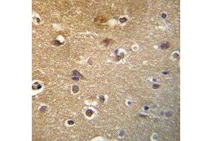 Immunohistochemistry (IHC) image for anti-Histone Deacetylase 3 (HDAC3) (AA 383-412) antibody (ABIN3031229)