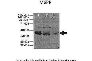 Human, Mouse (M6PR Antikörper  (N-Term))