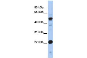 WB Suggested Anti-CSRP1 Antibody Titration:  0.