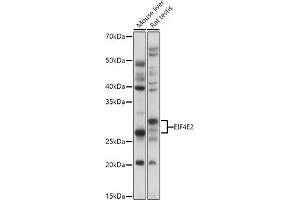 Western blot analysis of extracts of various cell lines, using EIF4E2 antibody (ABIN6130366, ABIN6140086, ABIN6140087 and ABIN6220578) at 1:1000 dilution. (EIF4E2 Antikörper  (AA 1-240))