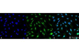 Immunocytochemistry/Immunofluorescence analysis using Mouse Anti-MDC1 Monoclonal Antibody, Clone P2B11 . (MDC1 Antikörper  (N-Term) (APC))