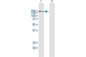 Western Blot analysis of A2M expression in transfected 293T cell line by A2M MaxPab polyclonal antibody. (alpha 2 Macroglobulin Antikörper  (AA 1-1474))