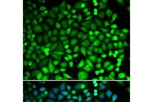 Immunofluorescence analysis of MCF-7 cells using PSMB2 Polyclonal Antibody (PSMB2 Antikörper)